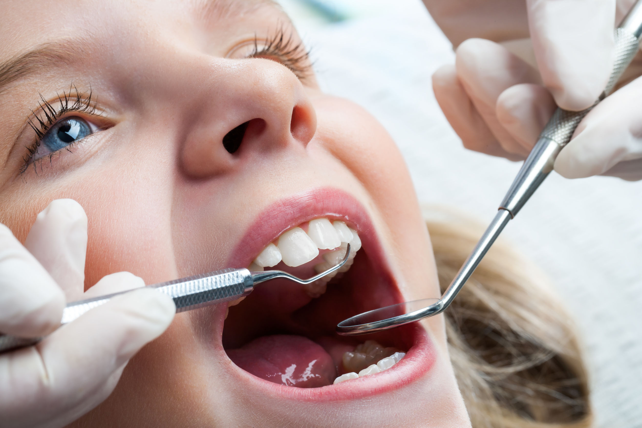 Tratamiento dental niños